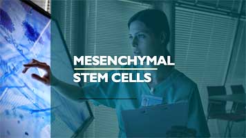 Mesenchymal Stem Cells